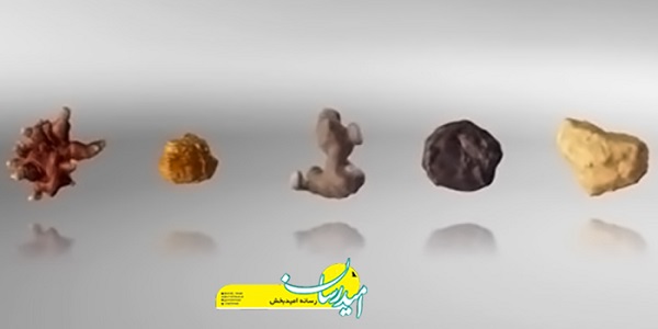 برای دفع سنگ کلیه چه چیزی بخوریم