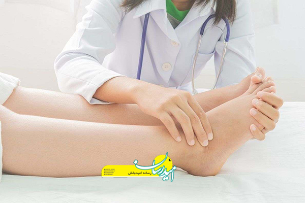 علت ورم کردن دست و پا در اول صبح