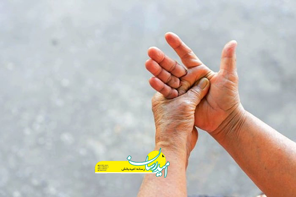 دلایل ورم کردن دست و پا در اول صبح