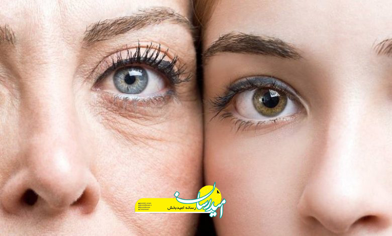 پماد ویتامین آ برای لک صورت