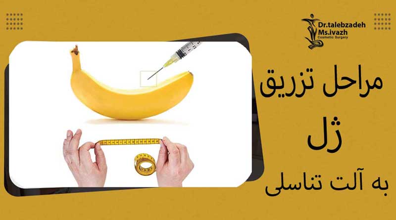 مراحل-تزریق-ژل-به-آلت-تناسلی