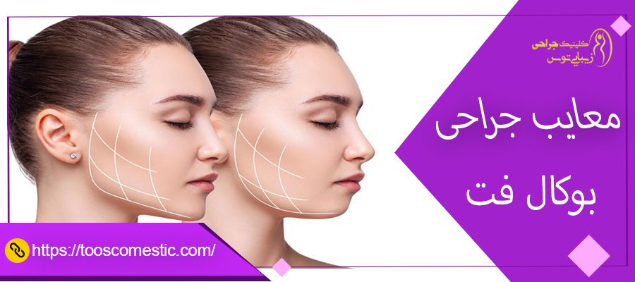 معایب بوکال فت